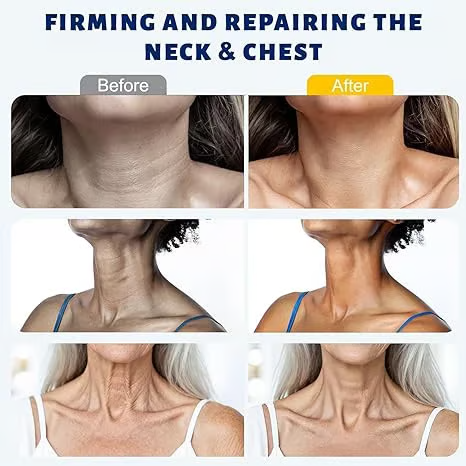 🆙Ivopalo® Roller Massage Neck Cream 🧴 Collagen & Hyaluronic Acid | Firms Neck, Reduces Wrinkles & Double Chin