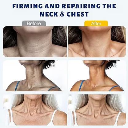 🆙Ivopalo® Roller Massage Neck Cream 🧴 Collagen & Hyaluronic Acid | Firms Neck, Reduces Wrinkles & Double Chin