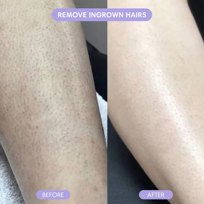 🆙✨2-in-1 Painless Bikini Hair Trimmer for Face & Body