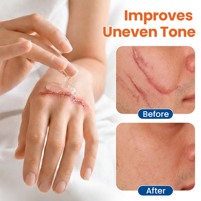 ✨💧 ivopalo®Professional Skin Renewal Gel For Firmer, Smoother Skin
