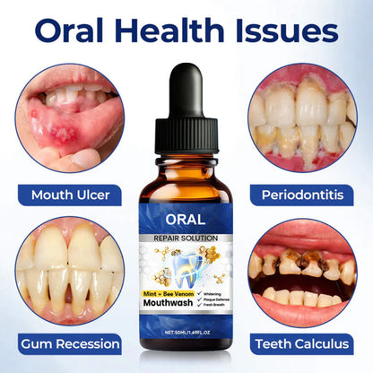 🆙 ivopalo® Advanced Oral Repair Care — Extra-Strength Bee Venom Drops Against Loose Teeth Bleeding Gums & Plaque — Premium Mouthwash Alternative