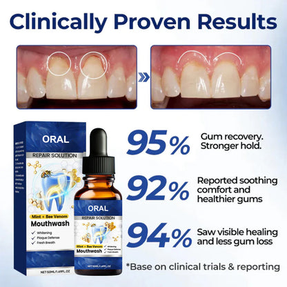 🆙 ivopalo® Advanced Oral Repair Care — Extra-Strength Bee Venom Drops Against Loose Teeth Bleeding Gums & Plaque — Premium Mouthwash Alternative