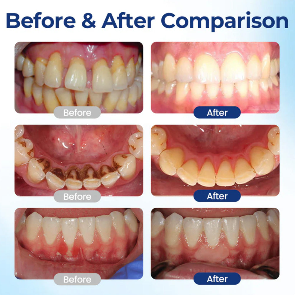 🆙 ivopalo® Advanced Oral Repair Care — Extra-Strength Bee Venom Drops Against Loose Teeth Bleeding Gums & Plaque — Premium Mouthwash Alternative