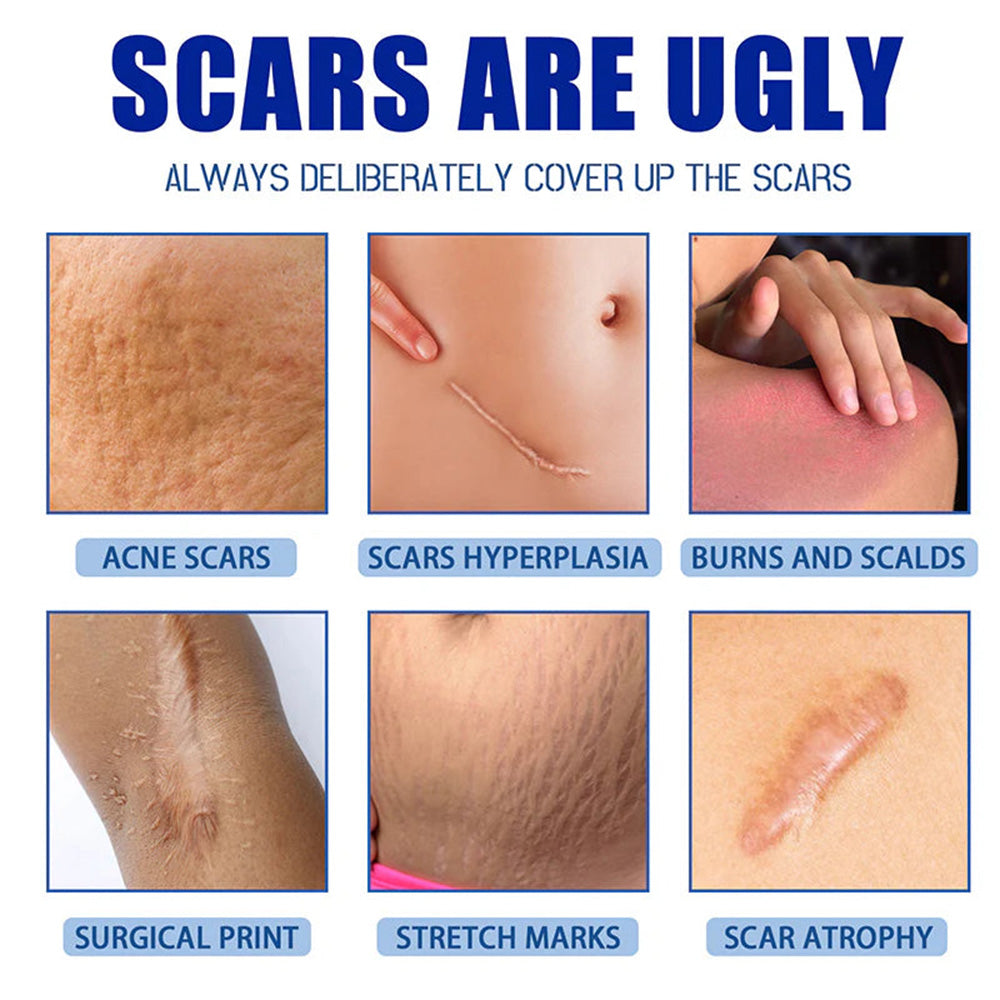 🫧ivopalo® Advanced Scar Repair Cream – Fade Scars & Smooth Skin for All Skin Types
