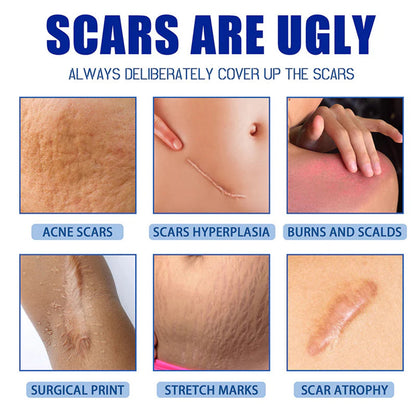 🫧ivopalo® Advanced Scar Repair Cream – Fade Scars & Smooth Skin for All Skin Types