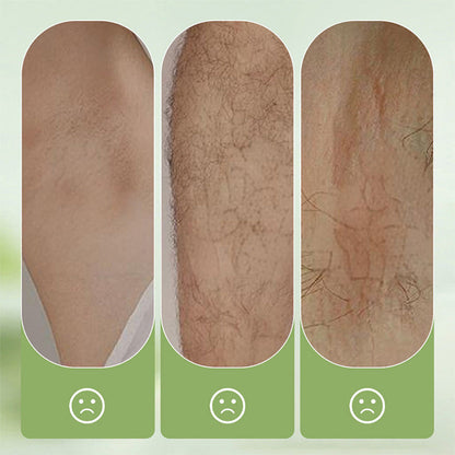 🆙 Ivopalo® Gentle and Non-Irritating Hair Removal Cream