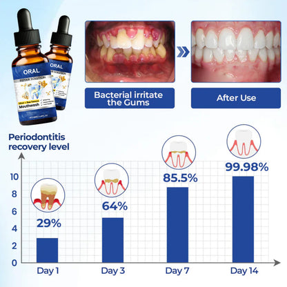 🆙 ivopalo® Advanced Oral Repair Care — Extra-Strength Bee Venom Drops Against Loose Teeth Bleeding Gums & Plaque — Premium Mouthwash Alternative