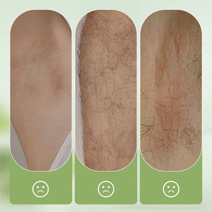 🫧  Ivopalo® Gentle and Non-Irritating Hair Removal Cream