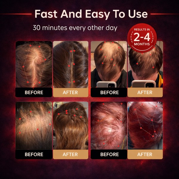 🔴 Ivopalo® Red Light Therapy Hair Cap – At-Home Scalp Care Cap for Fuller-Looking Hair
