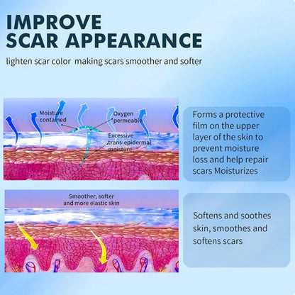 🆙Ivopalo® Advanced Silicone Scar Gel – Professional Scar Removal Cream for Surgical Scars, Keloids, Stretch Marks, C-Section & Old or New Scars Repair Treatment