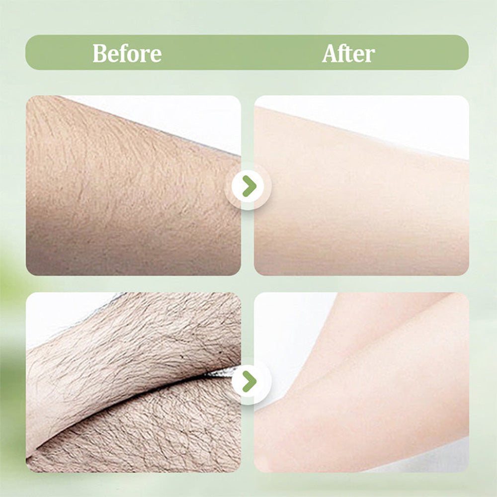 🆙 Ivopalo® Gentle and Non-Irritating Hair Removal Cream