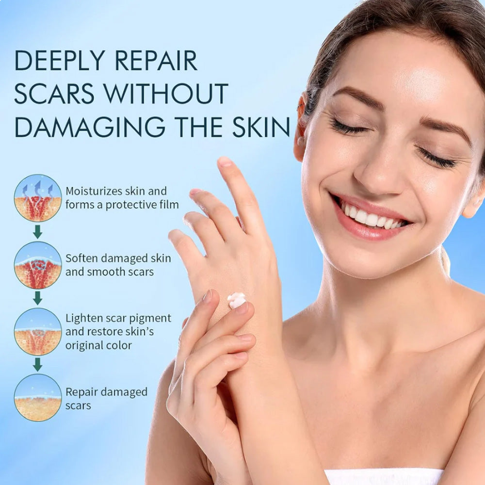 🆙Ivopalo® Advanced Silicone Scar Gel – Professional Scar Removal Cream for Surgical Scars, Keloids, Stretch Marks, C-Section & Old or New Scars Repair Treatment