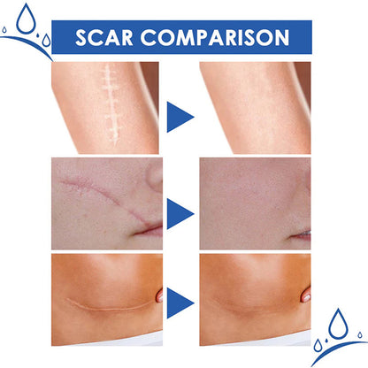 🫧ivopalo® Advanced Scar Repair Cream – Fade Scars & Smooth Skin for All Skin Types