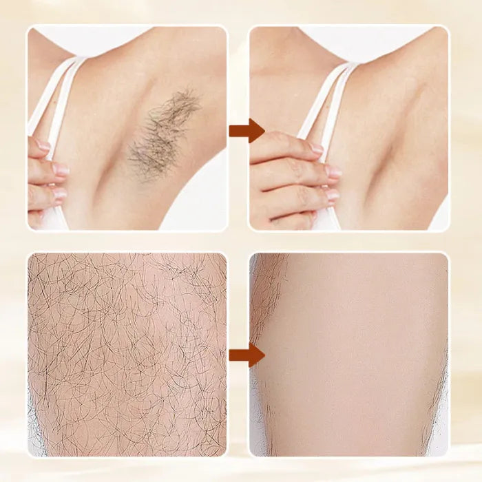 🫧Ivopalo® Instant Painless Hair Removal Cream for Sensitive Skin
